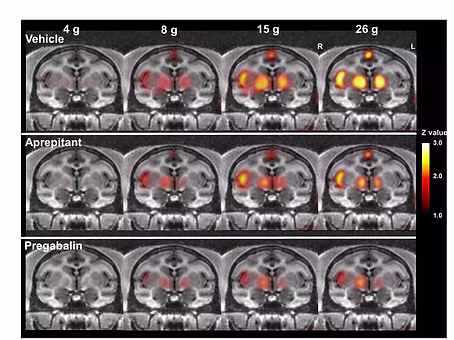 cmic in vivo imaging 6 Brain activation with fMRI