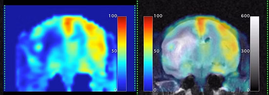 cmic in vivo imaging 9 Cerebral blood flow perfusion MRI